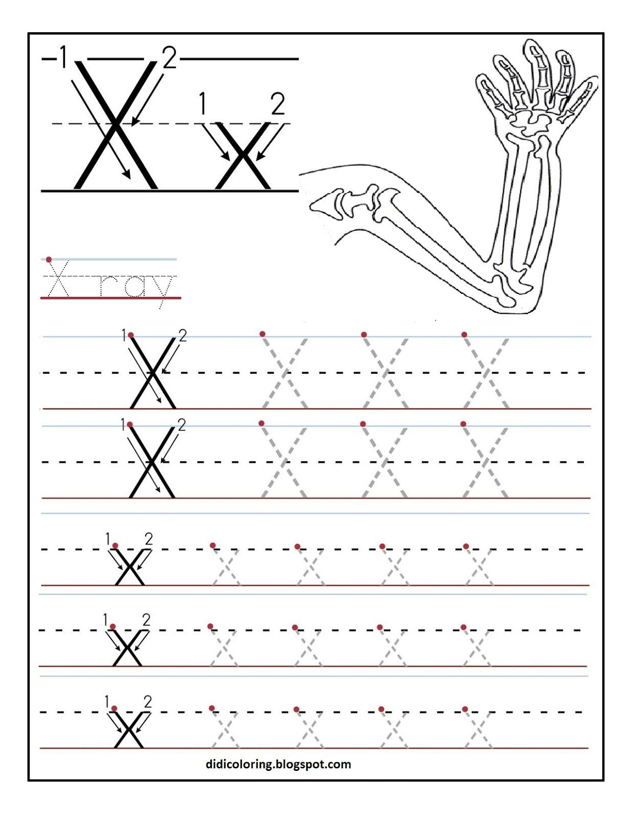 Printable+Letter+X+Tracing+Worksheets+For+Kids (1236